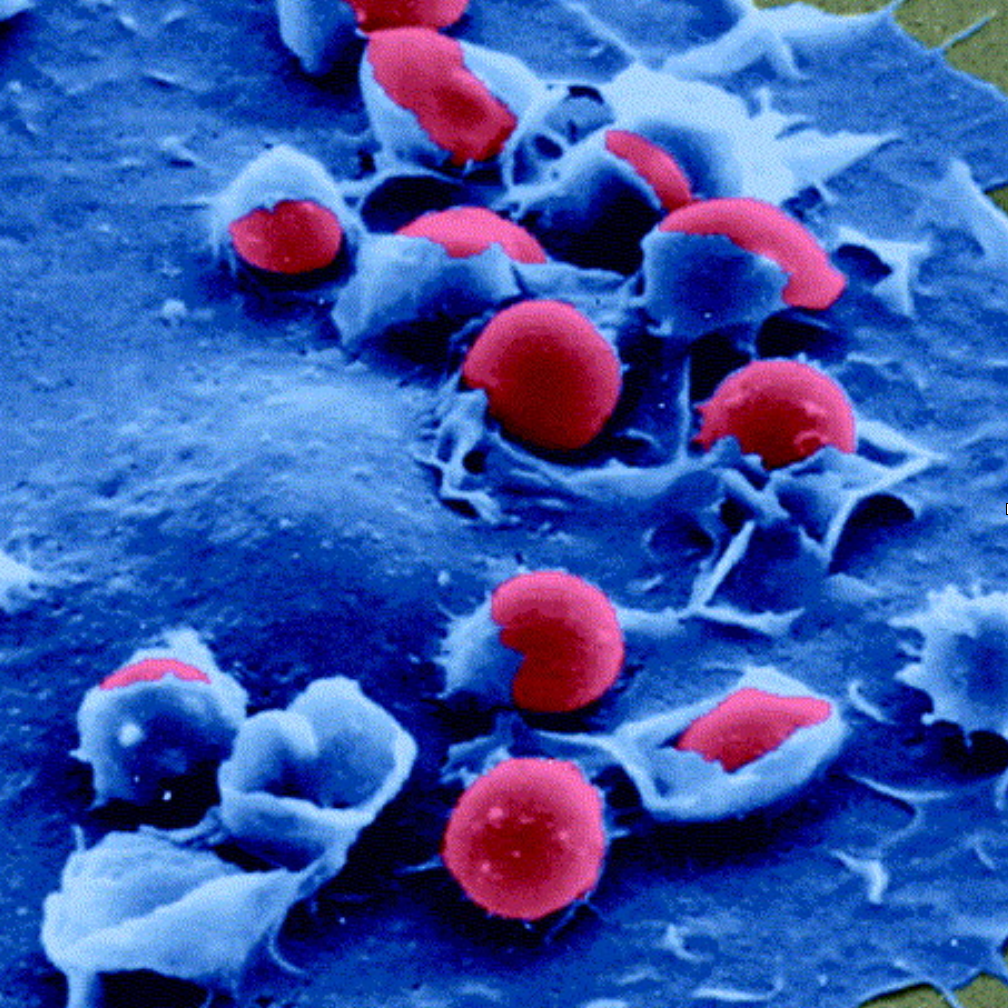 Image for the paper "Immune networks: multi-tasking capabilities at medium load"